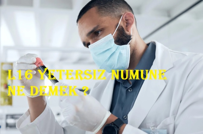 L16 yetersiz numune ne demek