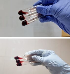 L16 yetersiz numune ne demek1