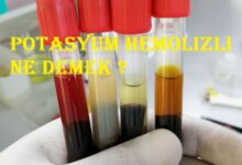 Potasyum hemolizli ne demek ?