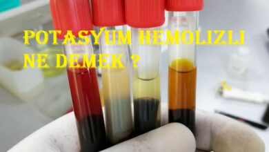 Potasyum hemolizli ne demek ?